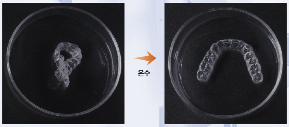 Direct Aligner 형상기억 — 변형 후 온수에서 원형 복원